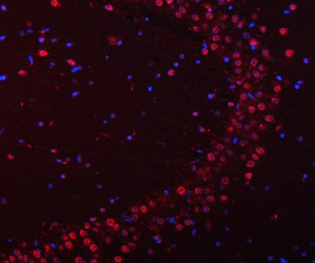 SNRPN Rabbit Polyclonal Antibody