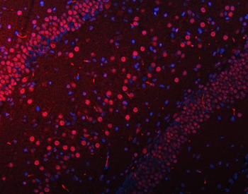 SNRPN Rabbit Polyclonal Antibody