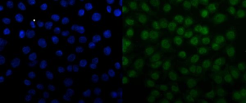 SNRPN Rabbit Polyclonal Antibody