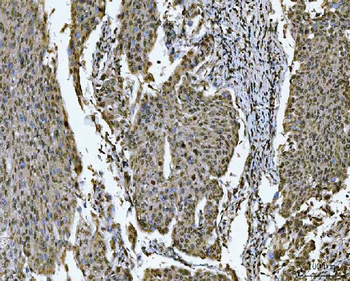 SNRPN Rabbit Polyclonal Antibody