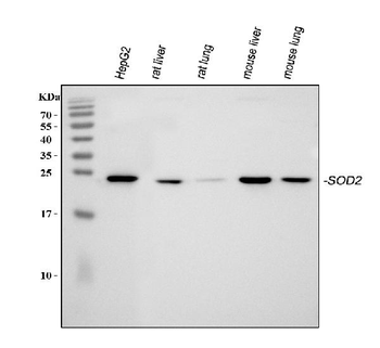 SOD2 Rabbit Polyclonal Antibody