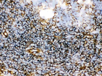 Transglutaminase 2/TGM2 Rabbit Polyclonal Antibody