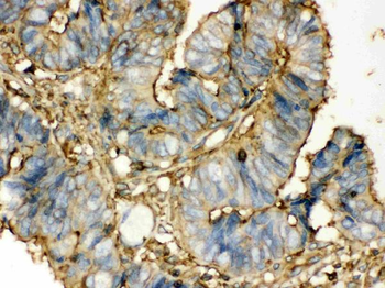 Transglutaminase 2/TGM2 Rabbit Polyclonal Antibody