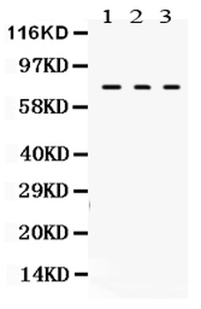 Transglutaminase 2/TGM2 Rabbit Polyclonal Antibody