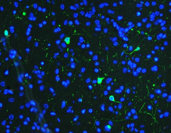 Tyrosine Hydroxylase/TH Rabbit Polyclonal Antibody