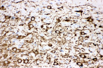 Tyrosine Hydroxylase/TH Rabbit Polyclonal Antibody