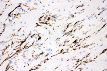Tyrosine Hydroxylase/TH Rabbit Polyclonal Antibody