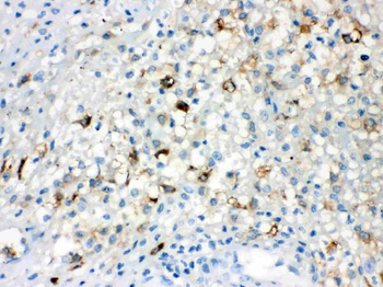 TLR5 Rabbit Polyclonal Antibody