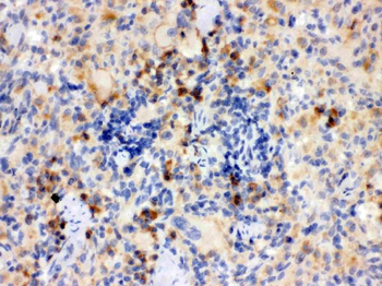 TLR7 Rabbit Polyclonal Antibody