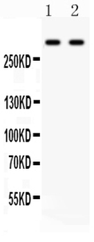 Versican/VCAN Rabbit Polyclonal Antibody