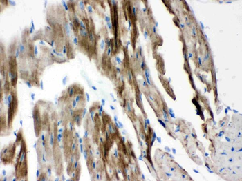 VDAC/Porin/VDAC1 Antibody
