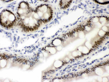 Vitamin D Receptor/VDR Antibody