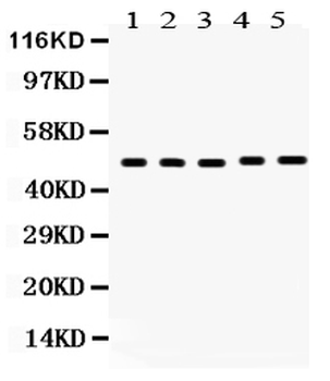 Vitamin D Receptor/VDR Antibody