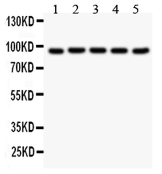 Villin/VIL1 Antibody