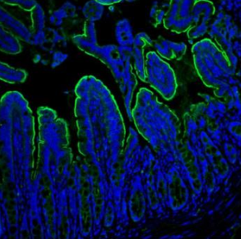 Villin/VIL1 Antibody