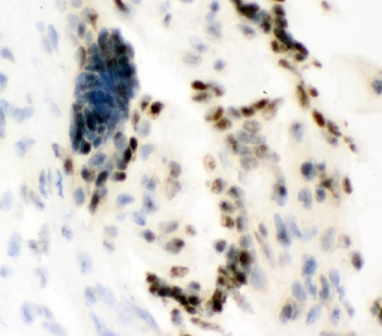 Ku80/XRCC5 Rabbit Polyclonal Antibody