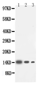 Interleukin-4 IL4 Rabbit Polyclonal Antibody