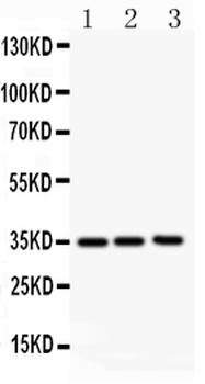 GM-CSF/CSF2/GM Rabbit Polyclonal Antibody