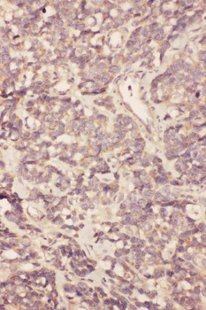 Fibroblast growth factor 19 FGF19 Antibody