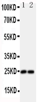 Fibroblast growth factor 19 FGF19 Antibody
