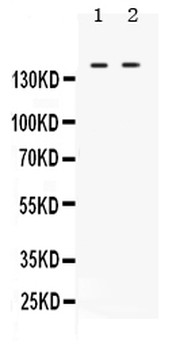c Abl/ABL1 Rabbit Polyclonal Antibody