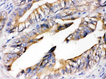 RAGE/AGER Rabbit Polyclonal Antibody