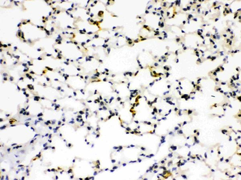 RAGE/AGER Rabbit Polyclonal Antibody