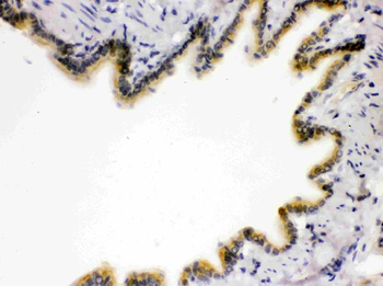 RAGE/AGER Rabbit Polyclonal Antibody