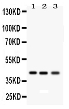RAGE/AGER Rabbit Polyclonal Antibody