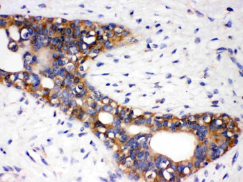 Angiotensin II Type 1 Receptor/AGTR1 Rabbit Polyclonal Antibody