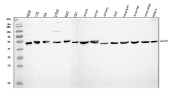 Angiotensin II Type 1 Receptor/AGTR1 Rabbit Polyclonal Antibody