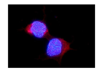 ALDH2 Rabbit Polyclonal Antibody