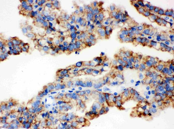 ALDH2 Rabbit Polyclonal Antibody