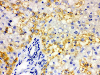 ALDH2 Rabbit Polyclonal Antibody