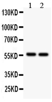ALDH2 Rabbit Polyclonal Antibody