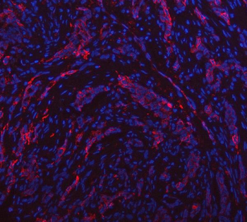Aquaporin 1/AQP1 Antibody