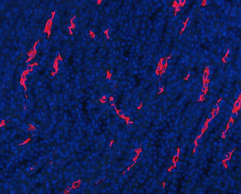 Aquaporin 1/AQP1 Antibody