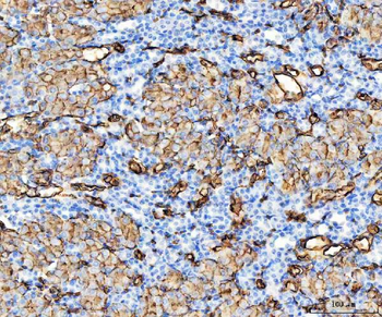 Aquaporin 1/AQP1 Antibody