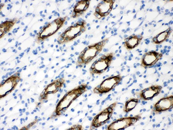 Aquaporin 2/AQP2 Rabbit Polyclonal Antibody