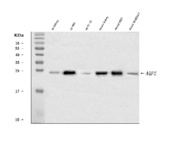 Aquaporin 2/AQP2 Rabbit Polyclonal Antibody