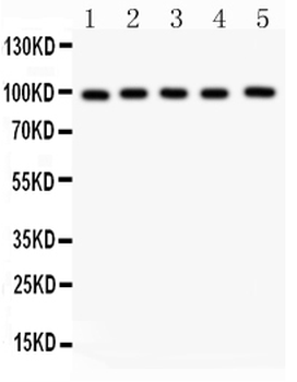 Aspartate beta hydroxylase/ASPH Antibody