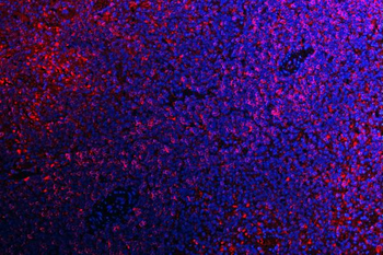 ATG14L Antibody