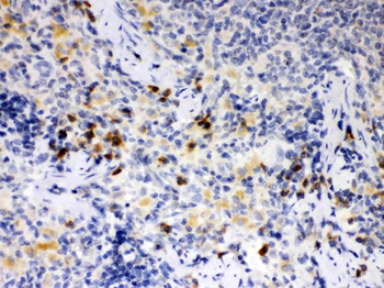 ATG14L Antibody