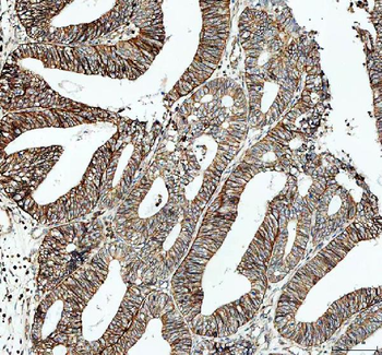 alpha 1 Sodium Potassium ATPase/ATP1A1 Rabbit Polyclonal Antibody