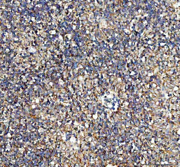 alpha 1 Sodium Potassium ATPase/ATP1A1 Rabbit Polyclonal Antibody