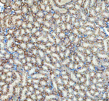 alpha 1 Sodium Potassium ATPase/ATP1A1 Rabbit Polyclonal Antibody