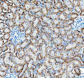 alpha 1 Sodium Potassium ATPase/ATP1A1 Rabbit Polyclonal Antibody