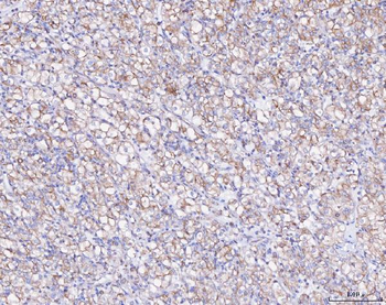 ATX2/ATXN2 Rabbit Polyclonal Antibody