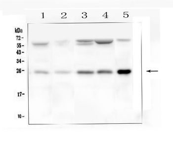 BAK/BAK1 Antibody