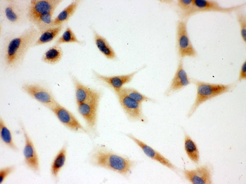 BAK/BAK1 Antibody
